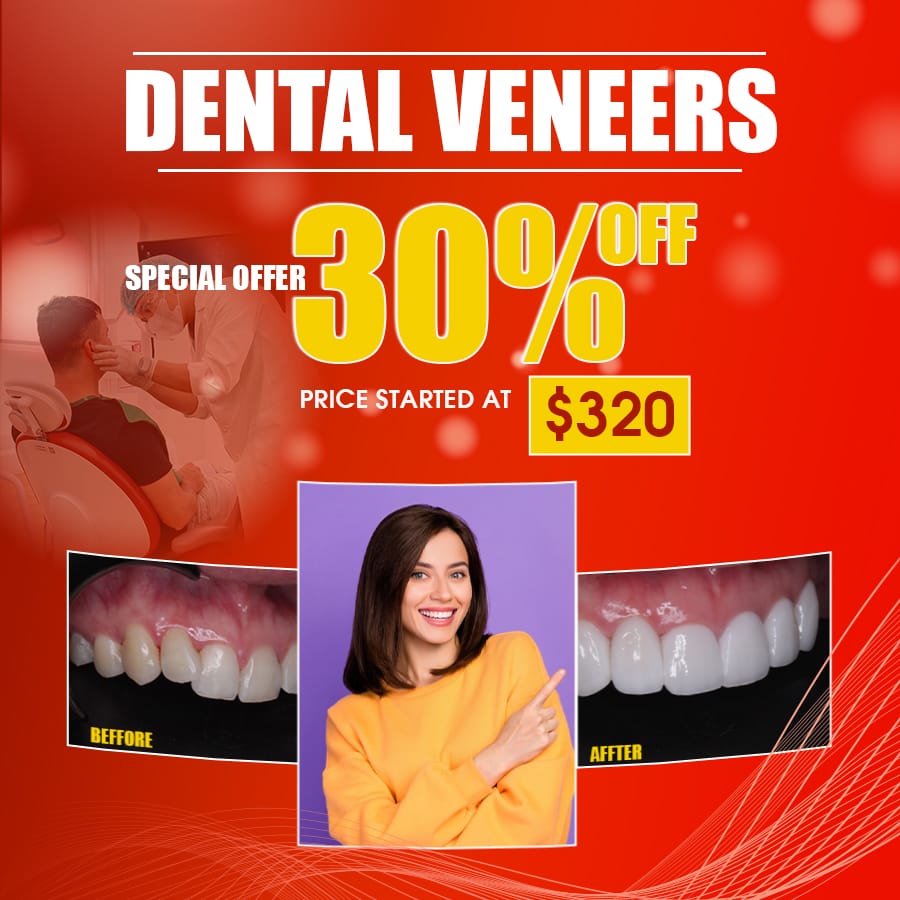 best dental veneers vietnam best dental veneers vietnam