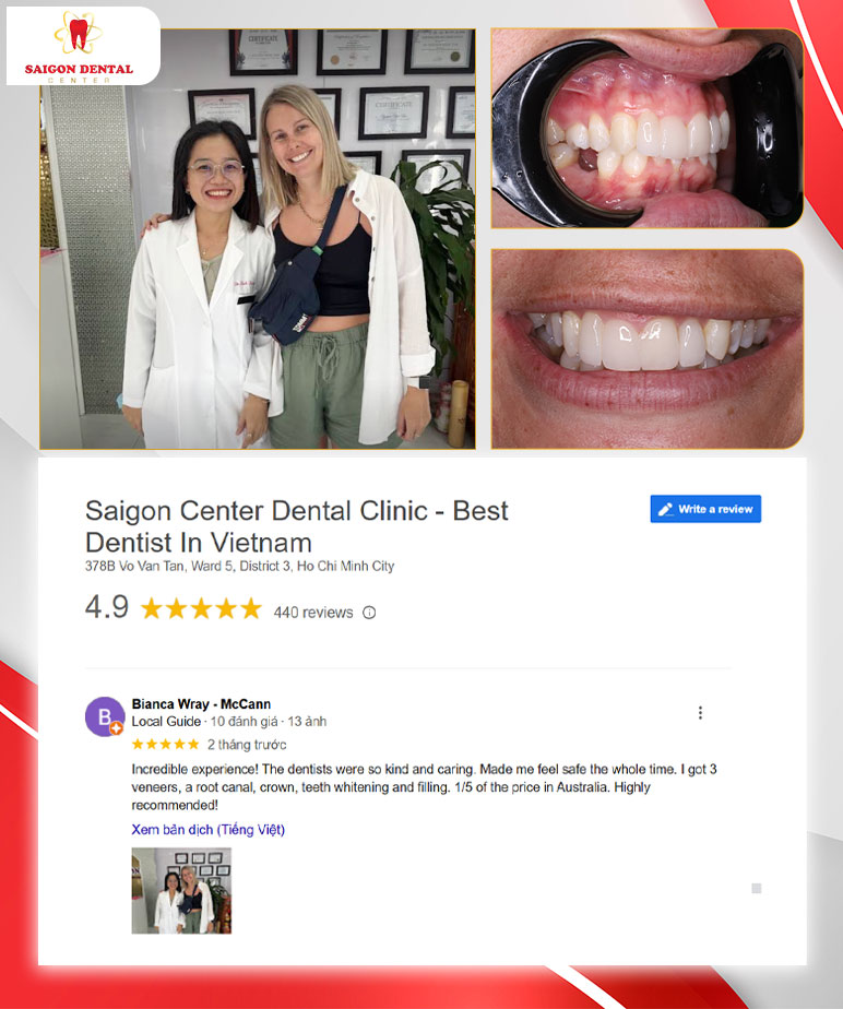 customer review dental veneers customer review dental veneers
