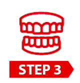 dental veneer proceduce 2