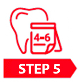 dental veneer proceduce 4